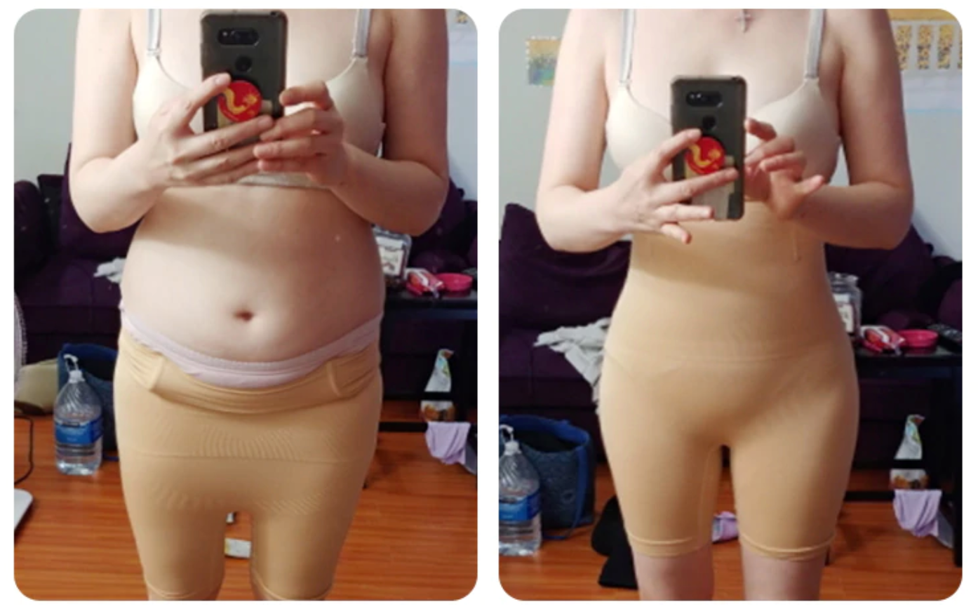 MamaForm Luxe™ | Feel Your Best