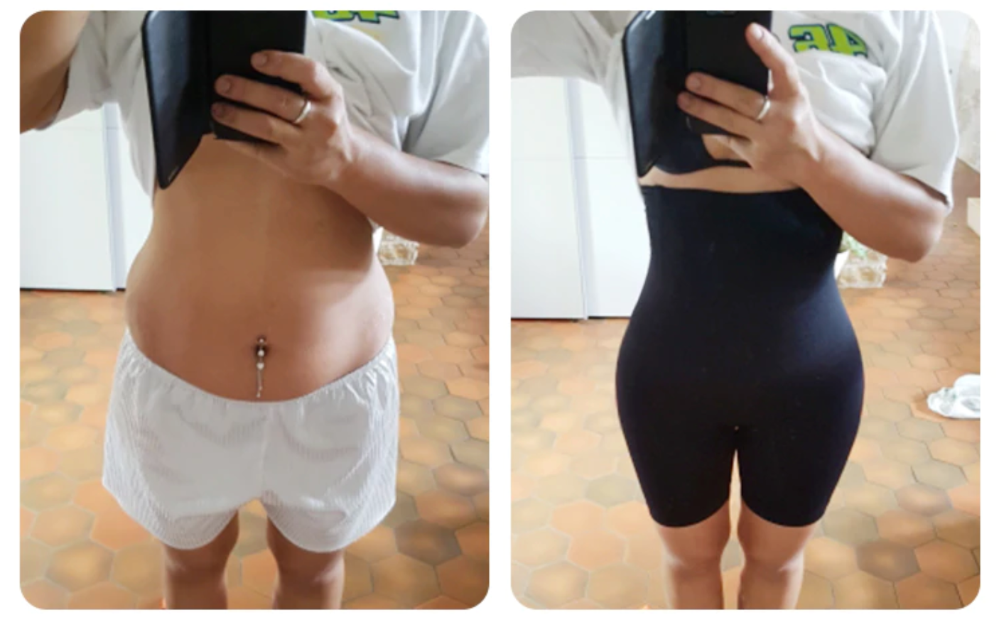 MamaForm Luxe™ | Feel Your Best
